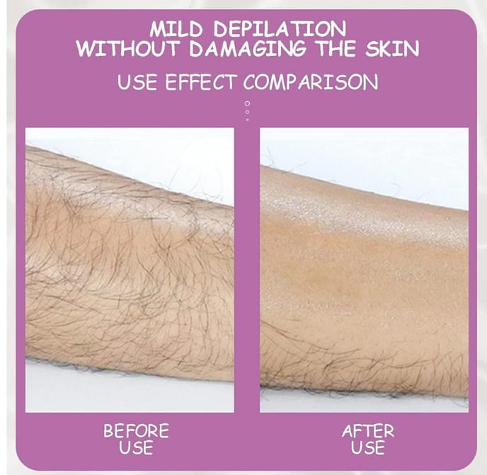 Hair Remover Epilator